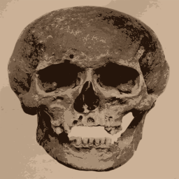 인간 Skull 와 A Missing Jaw