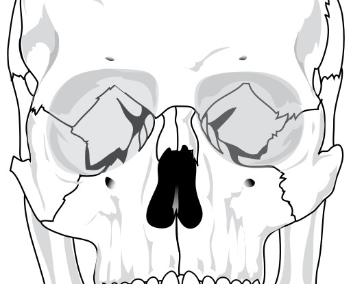 더 낮은 Jaw 없이 인간적인 Skull