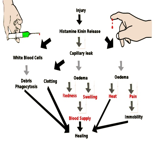 Diagram, Showing Main Parts 의 English 텍스트